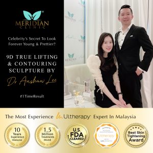 lifting treatment with ulthera joanne yew